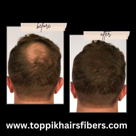 Demo: How to use Toppik to Conceal areas of Hair Loss and Thinning